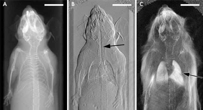 X-ray images in a mouse obtained with, A, standard attenuation-based imaging, B, phase-contrast imaging, and, C, dark-field imaging. Arrow indicates regions of enhanced contrast in the trachea (B) and lungs (C). (Reprinted, with permission, from reference 69.)