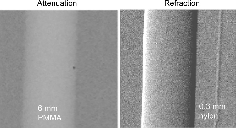 Attenuation-based radiograph and phase-contrast refraction radiograph of a poly(methyl methacrylate) (PMMA) rod and a 0.3-mm nylon filament immersed in a 5-cm-thick water bath. The images were obtained at 60 kVp with a glancing angle interferometer. The computed radiation dose is 2 mGy absorbed dose. The thin filament is invisible on the conventional image (left) but has good contrast with refraction (right).