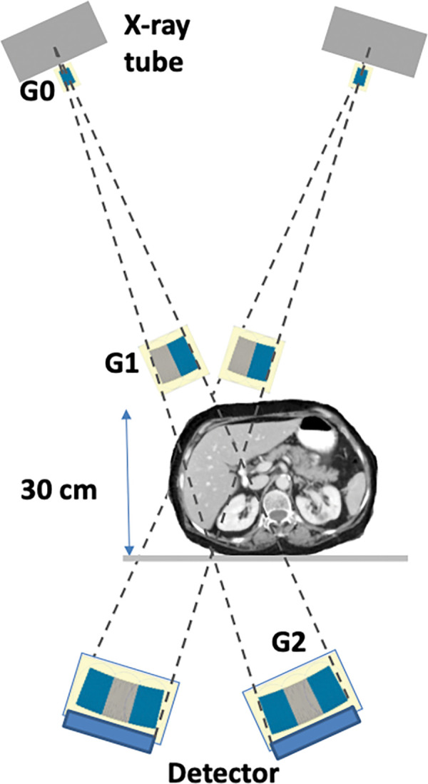 High-energy region-of-interest phase-contrast tomosynthesis system for the internal organs based on the glancing angle interferometer design. G = grating.