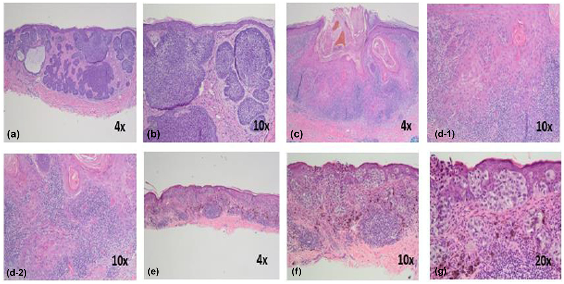 Figure 1: