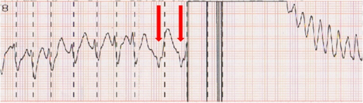 Fig. 3