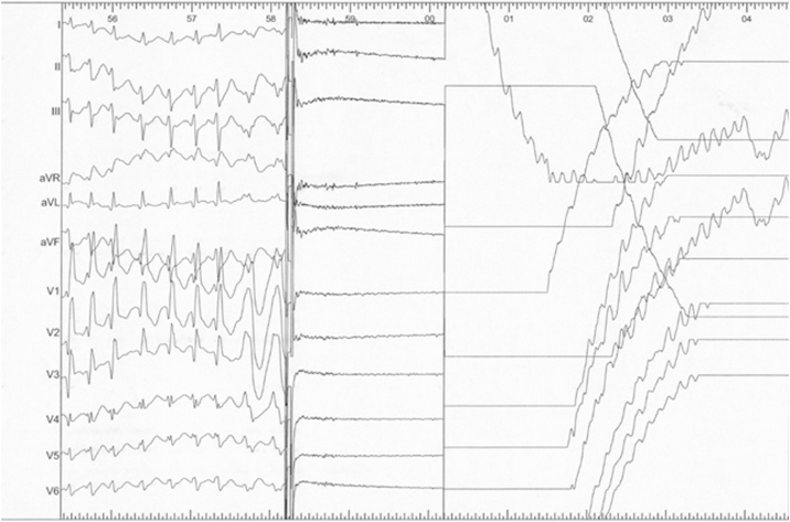 Fig. 2