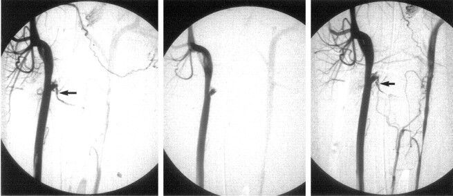 Fig 2.