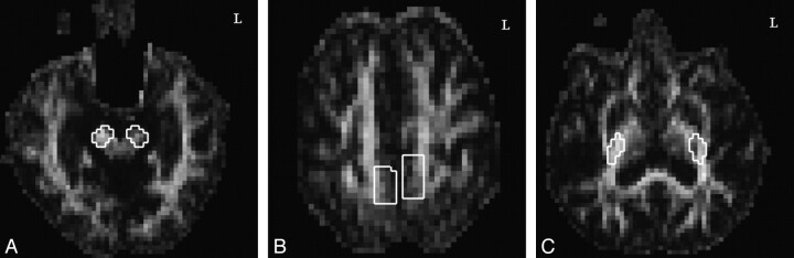 Fig 1.