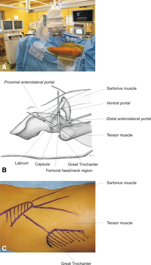 Fig. 1A–C