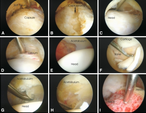 Fig. 2A–I