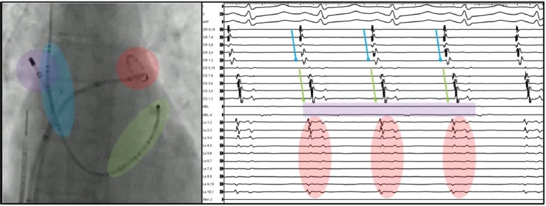 Figure 1: