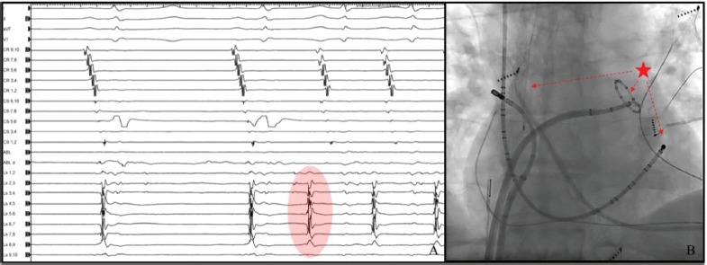 Figure 3: