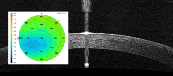 Fig. 2