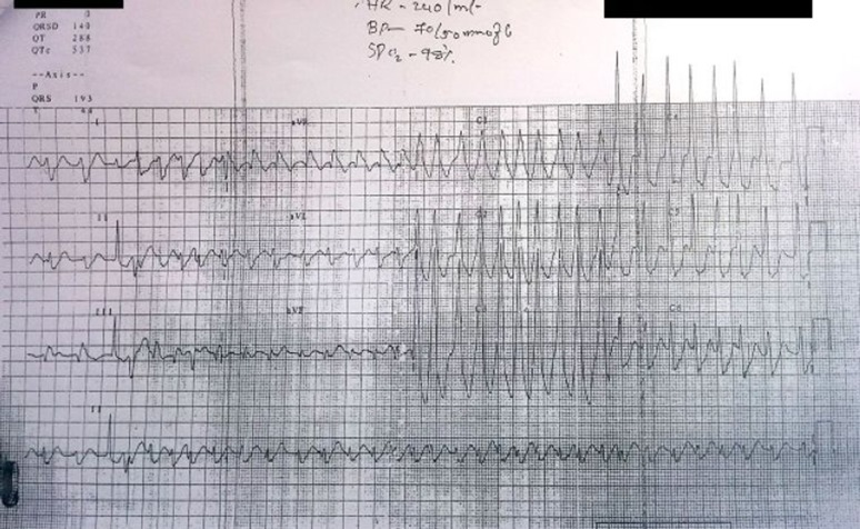 Fig. 1