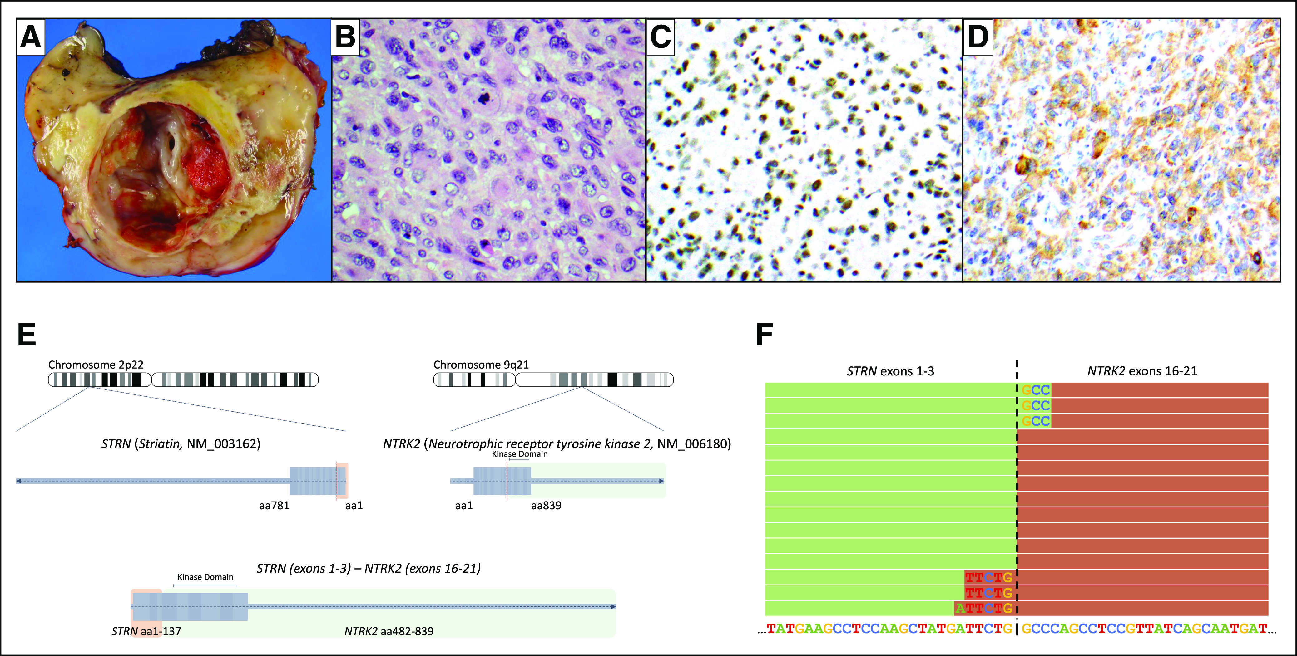 Fig 3.