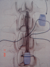 Fig. 1