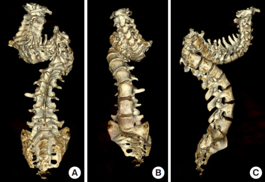 Fig. 2.