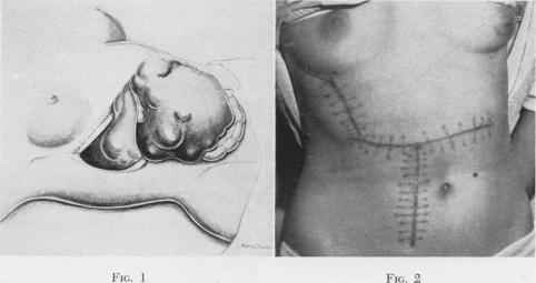 Fig. 1., Fig. 2.