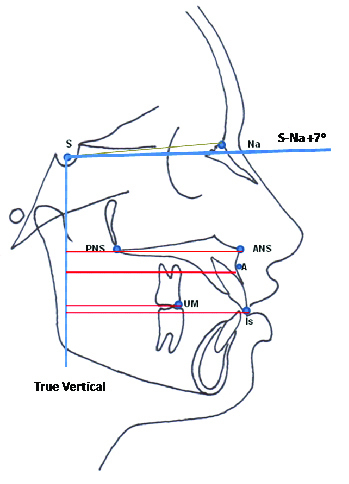 [Table/Fig-2]: