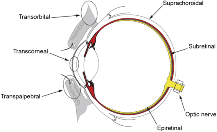 Figure 1