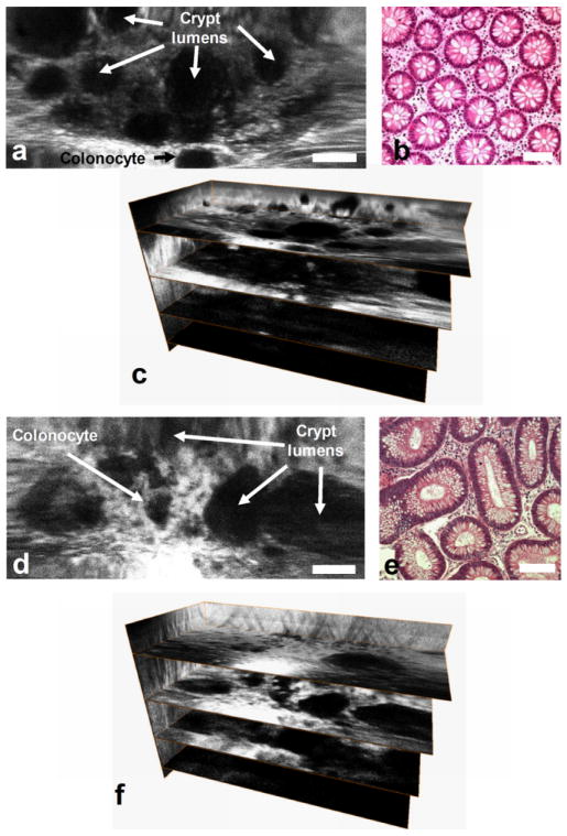 Fig. 13