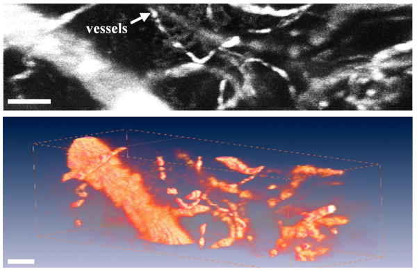 Fig. 15