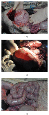 Figure 11