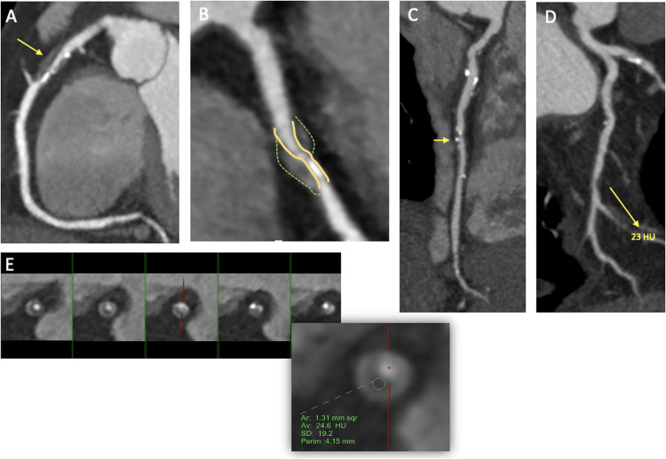 Fig 2