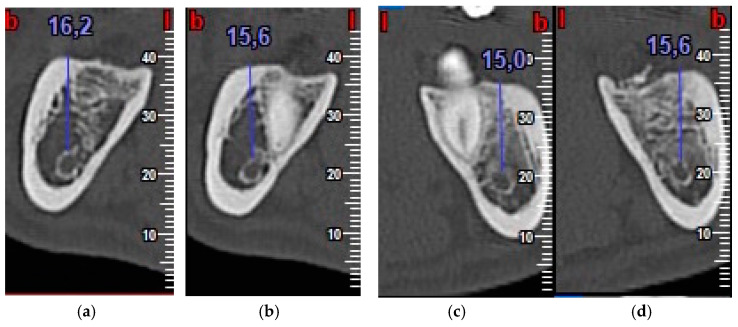 Figure 9