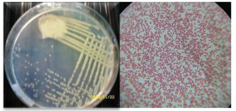 Using Cellulolytic Nitrogen Fixing Bacterium, Azomonas agilis for ...