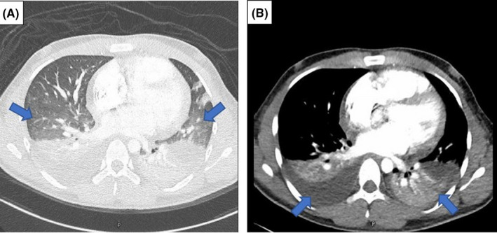 FIGURE 3