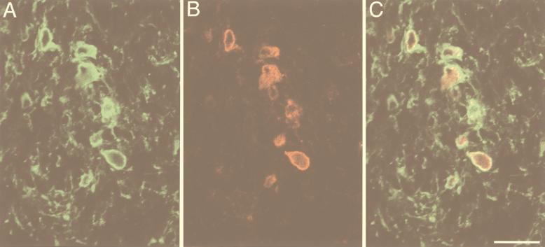 FIG. 5