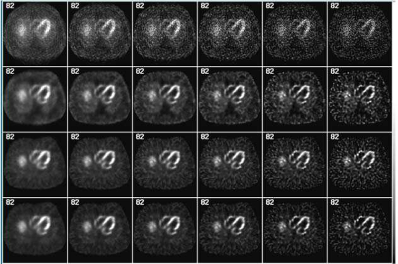 Fig. 15.