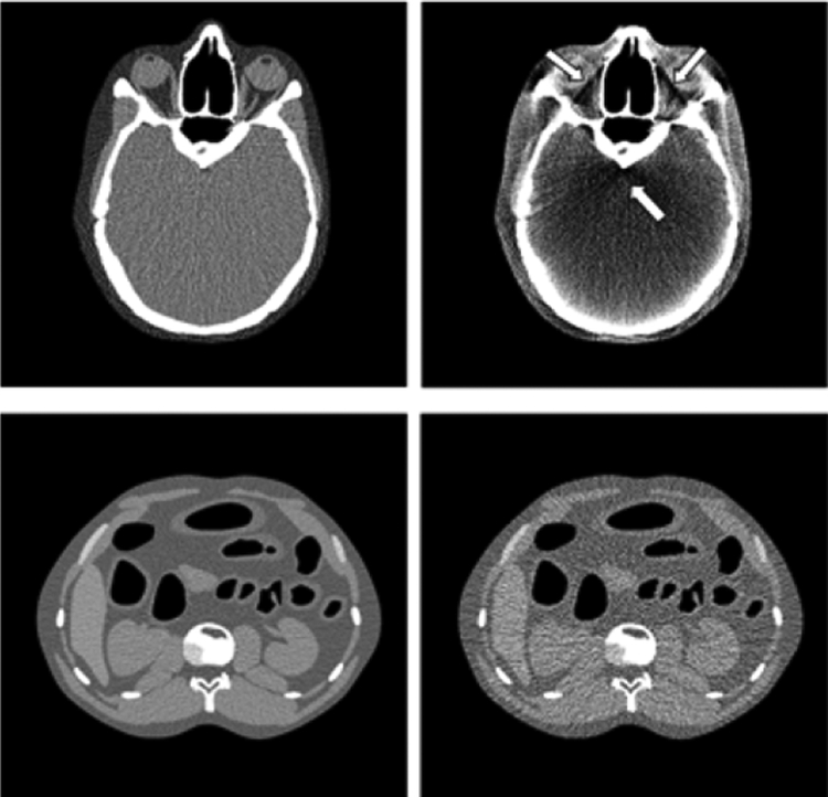 Fig. 13.