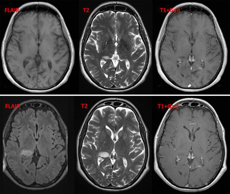 FIG. 3.
