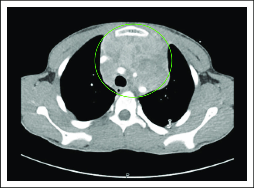 FIG 1.