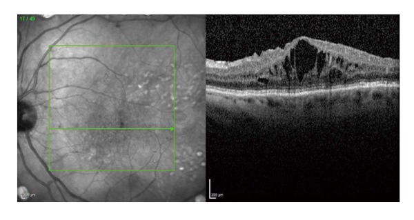 Figure 11