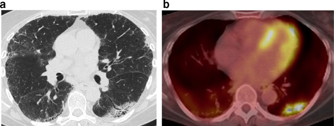 Figure 12.