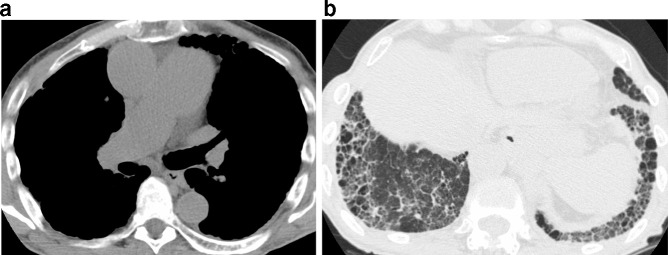 Figure 13.