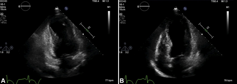 Figure 3