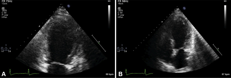 Figure 4