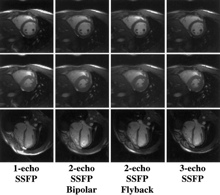 FIG. 3