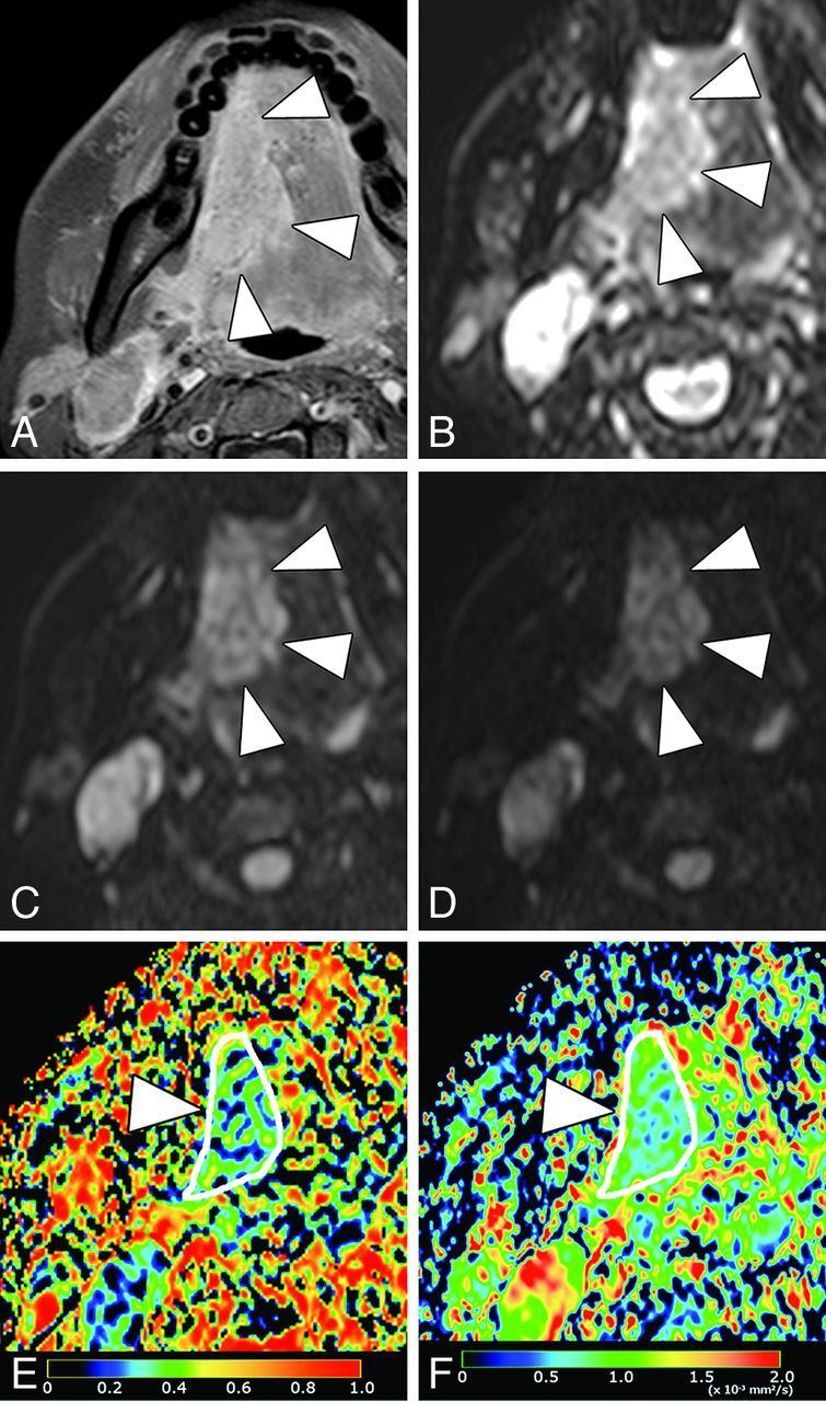 Fig 3.