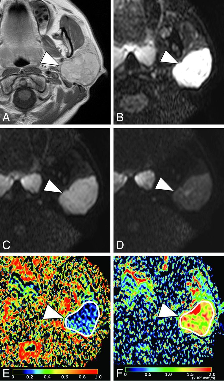 Fig 4.