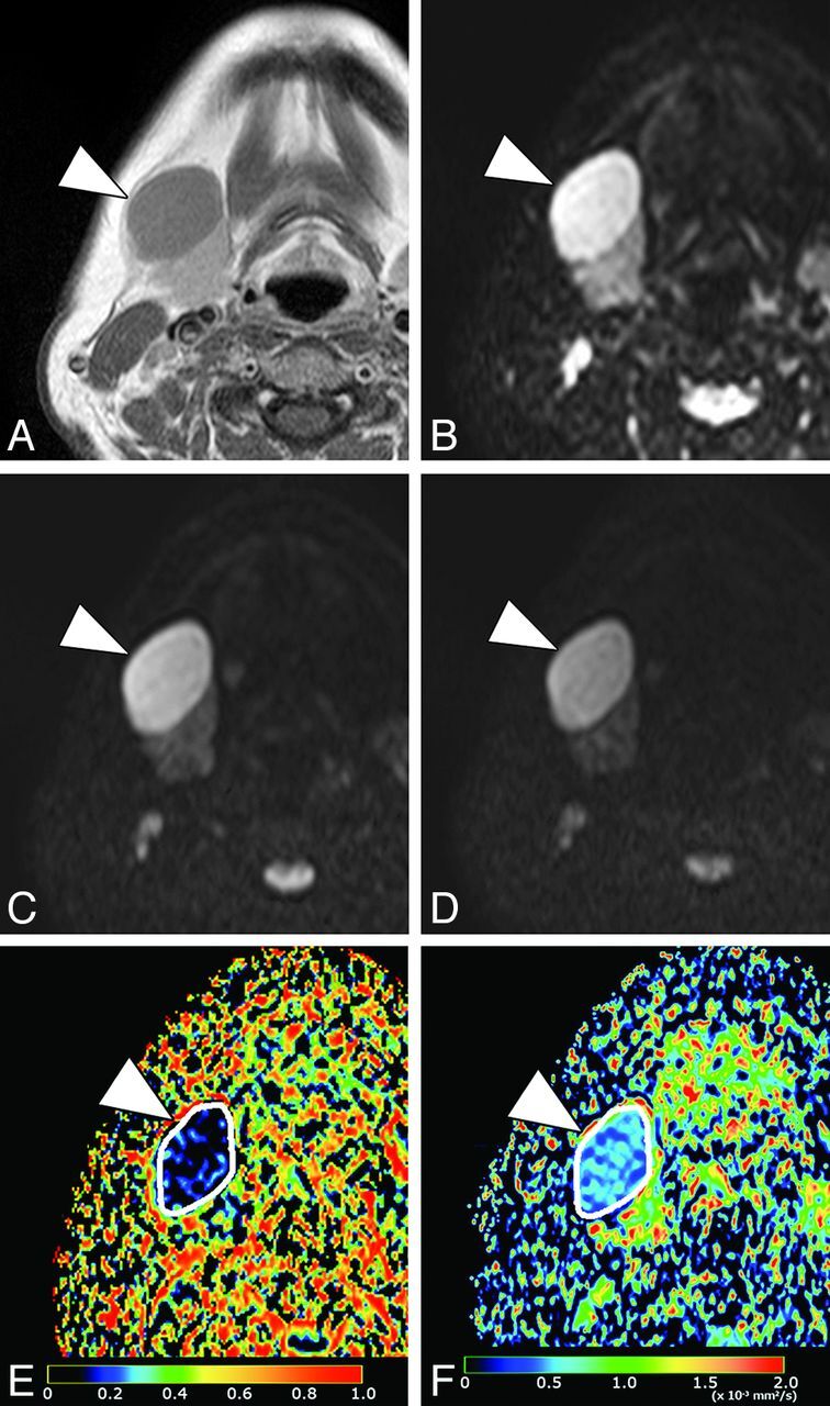 Fig 2.