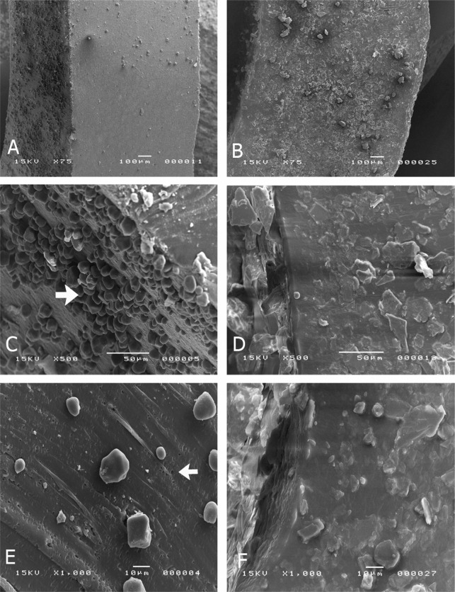 Figure 5. SEM micrographs of latex elastics (A, C, E) and nonlatex elastics (B, D, F) at 75× to 1000× magnifications. The intact latex elastics revealed the presence of microspheres on the surface (arrow C). When sectioned, these elastics presented microspheres and porosities on their inner surface (arrow E). The intact nonlatex elastics presented crystalloid structures on the surface (B, D). When sectioned, these elastics did not present porosities (F).