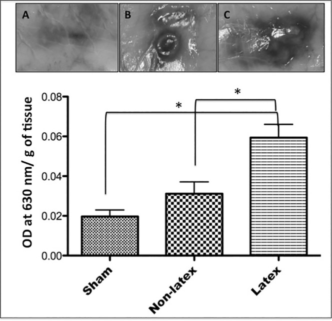 Figure 1. Mean values (± standard deviation) of the amount of Evans blue dye (OD indicates optical density) overflown per gram of tissue, measured by spectrophotometry 24 hours after implantation in the subcutaneous tissue. (A) Sham. (B) Nonlatex. (C) Latex. NS indicates nonsignificant statistical difference. * P > .05.