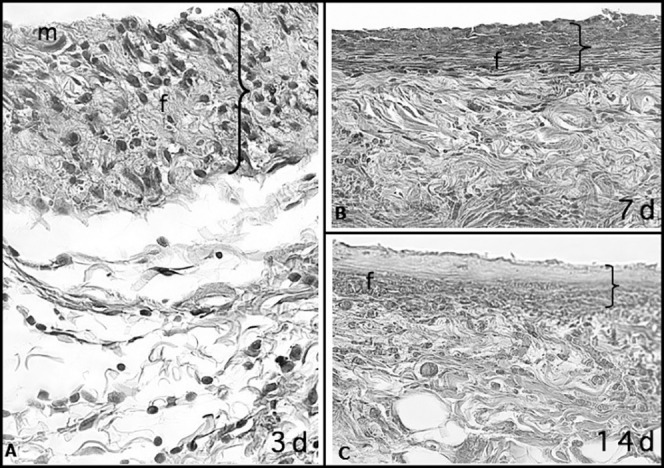 Figure 2. Capsular tissue around a nonlatex elastic with numerous macrophages (m) and few neutrophils at 3 days. At 7 and 14 days, fiber formation (f) was more intense than at 3 days and with the formation of fibrous capsule. The greater thickness of the capsule at 3 days is probably due to the greater accumulation of cells and edema, which were significantly reduced at 7 and 14 days (HE; 40× magnification).