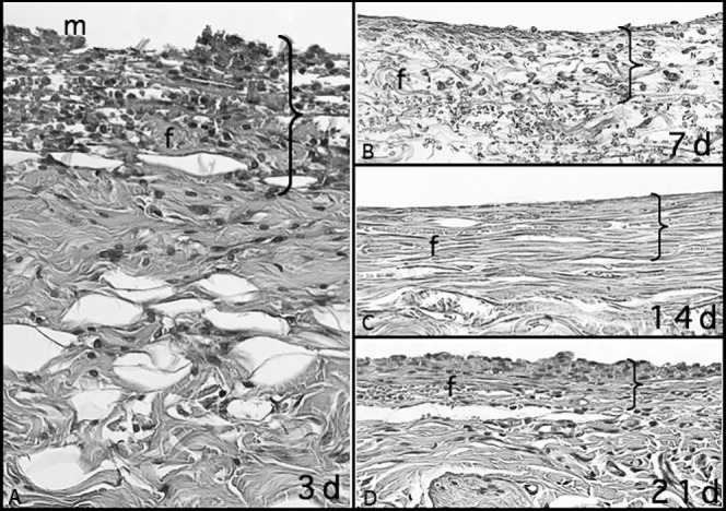 Figure 3. Capsular tissue around a latex elastic with numerous macrophages (m) and some neutrophils at 3 days. Fiber formation (f) was greater at 7, 14, and 21 days than at 3 days, and the fibers were organized in the form of a fibrous capsule. The greater thickness at 3 days refers to higher accumulation of cells and edema, which were significantly reduced at 7, 14, and 21 days (HE; 40× magnification).