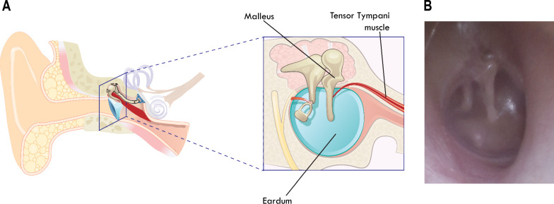 Fig. 1