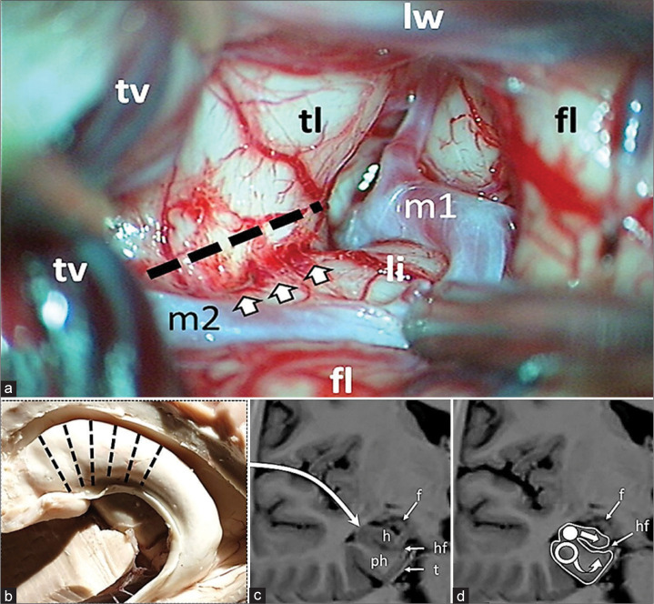 Figure 1: