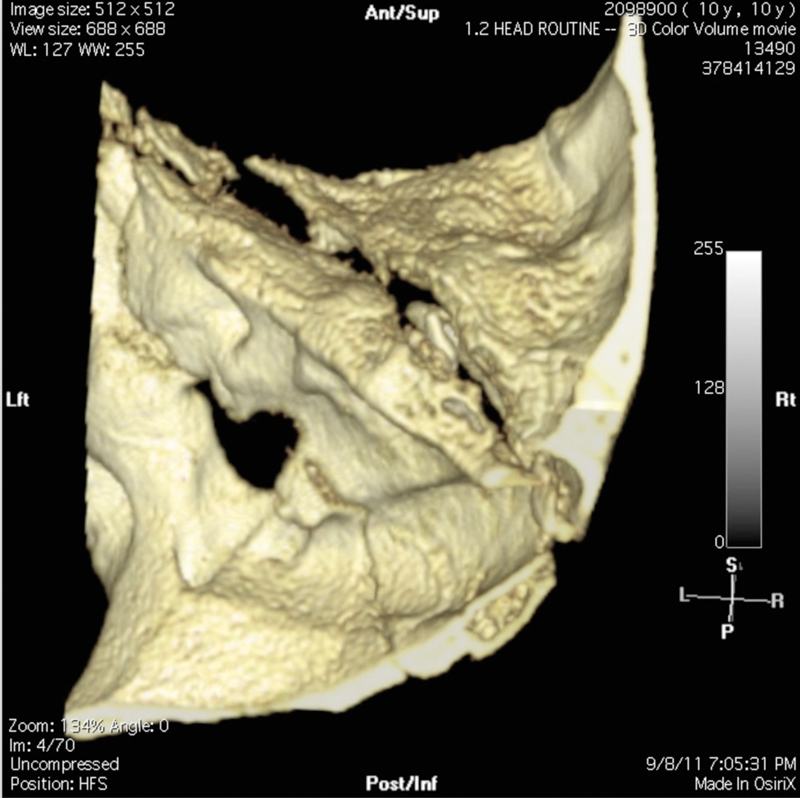 Fig. 8