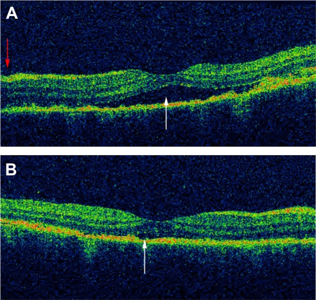 Figure 12