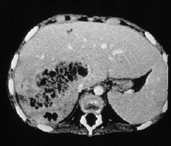 graphic file with name 978-3-662-57295-5_10_Fig1_HTML.jpg